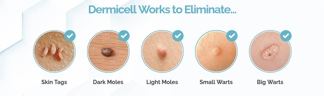 Dermicell Skin Tag Remover